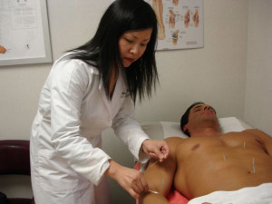 10 Questions and Answers why Acupuncture can help with Fitness!